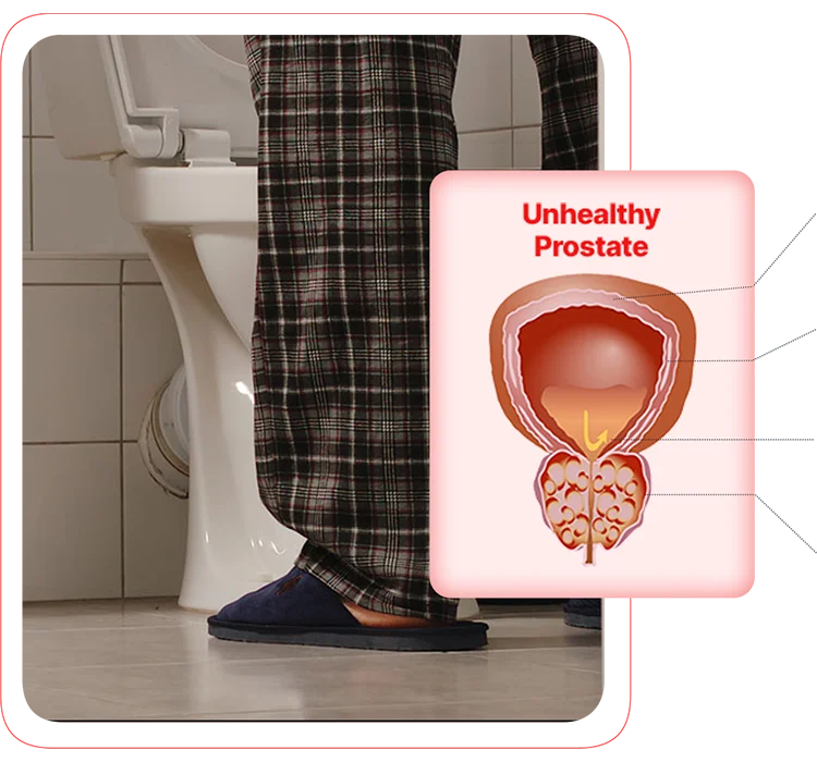 Prostate diagram